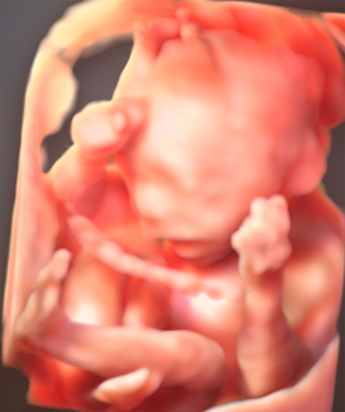 胎児ドックの写真